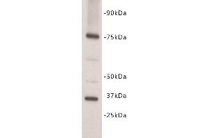 Western Blotting (WB) image for anti-Interleukin 7 Receptor (IL7R) (N-Term) antibody (ABIN1854927) (IL7R antibody  (N-Term))