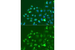 Immunofluorescence analysis of A549 cells using ATF3 antibody (ABIN6290025).