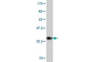Western Blot detection against Immunogen (37. (EIF3F antibody  (AA 258-357))