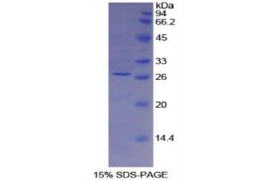 SDS-PAGE (SDS) image for Tissue Factor Pathway Inhibitor 2 (TFPI2) (AA 23-230) protein (His tag) (ABIN2122222)