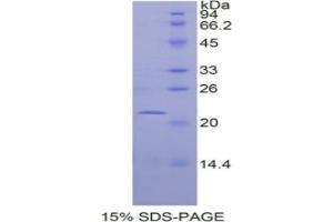 SDS-PAGE analysis of Mouse Fibulin 1 Protein.
