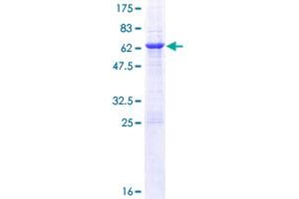 BCL7A Protein (AA 1-210) (GST tag)