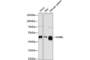 Western blot analysis of extracts of various cell lines, using HMBS antibody (ABIN3022529, ABIN3022530, ABIN3022531 and ABIN6218882) at 1:1000 dilution.
