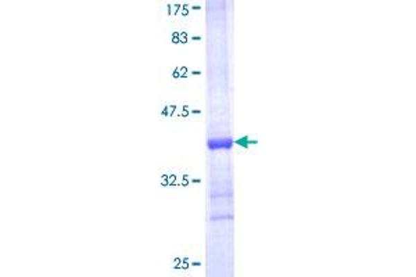 HUWE1 Protein (AA 4281-4374) (GST tag)