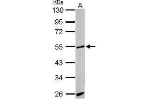 WB Image Sample (30 ug of whole cell lysate) A: BCL-1 10% SDS PAGE antibody diluted at 1:1000 (ACVRL1 antibody  (C-Term))