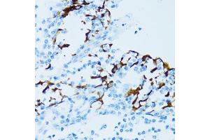 Immunohistochemistry of paraffin-embedded human tonsil using Cathepsin E (CTSE) antibody (ABIN3016440, ABIN3016441, ABIN3016442 and ABIN6219747) at dilution of 1:100 (40x lens). (Cathepsin E antibody)