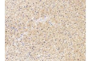 Detection of CLDN1 in Human Liver Tissue using Polyclonal Antibody to Claudin 1 (CLDN1) (Claudin 1 antibody  (AA 50-197))