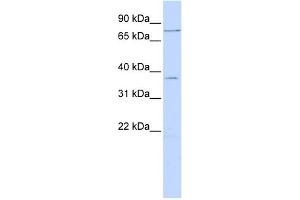 WB Suggested Anti-ZNF264 Antibody Titration:  0. (ZNF264 antibody  (N-Term))