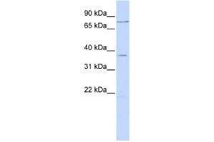 WB Suggested Anti-ZNF264 Antibody Titration:  0. (ZNF264 antibody  (N-Term))