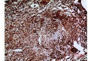 Immunohistochemistry (IHC) analysis of paraffin-embedded Human Lung, antibody was diluted at 1:100. (LAMC2 antibody  (C-Term))