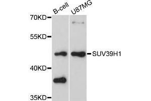 Western blot analysis of extracts of B-cell and U87MG cell lines, using SUV39H1 antibody.