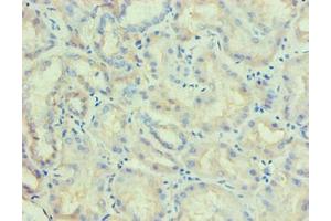 Immunohistochemical of paraffin-embedded human kidney tissue using ABIN7176818 at dilution of 1:200. (PLA2G7 antibody)