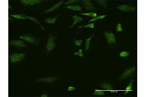 Immunofluorescence of monoclonal antibody to SCYE1 on HeLa cell. (AIMP1 antibody  (AA 1-312))