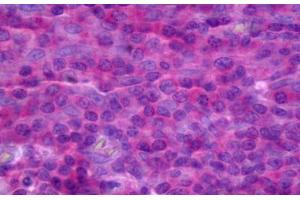 Anti-TNFRSF18 antibody IHC staining of human tonsil. (TNFRSF18 antibody  (AA 26-115))