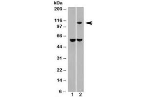 Western blot of HEK293 lysate overexpressing IDE probed with IDE antibody (mock transfection in lane 1). (IDE antibody)