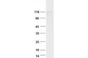 Validation with Western Blot