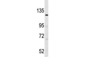 Western blot analysis of LATS1 antibody and K562 lysate. (LATS1 antibody  (AA 1-30))