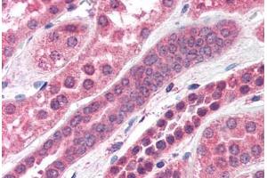 Human Kidney (formalin-fixed, paraffin-embedded) stained with STXBP6 antibody ABIN351472 at 3. (STXBP6 antibody  (AA 2-14))