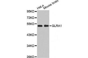 Western Blotting (WB) image for anti-Glycine Receptor, alpha 1 (GLRA1) (AA 29-247) antibody (ABIN6219938) (GLRA1 antibody  (AA 29-247))