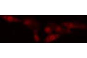 ABIN6274560 staining HeLa cells by IF/ICC. (Spindlin 1 antibody  (N-Term))