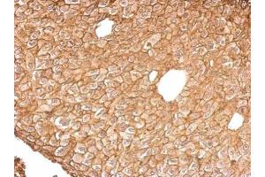 Immunohistochemistry (IHC) image for anti-Annexin A4 (ANXA4) antibody (ABIN2855591)