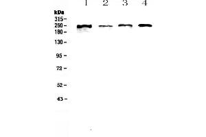Western blot analysis of SCRIBBLE using anti-SCRIBBLE antibody . (SCRIB antibody  (AA 172-409))