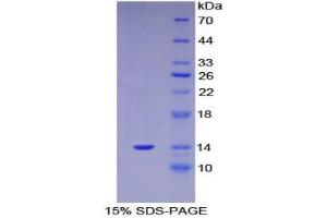 SDS-PAGE analysis of Human S100A11 Protein.