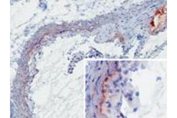 Mbl1 antibody