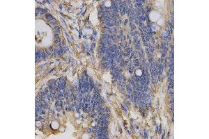 Immunohistochemistry (IHC) image for anti-Chloride Channel 5 (CLCN5) antibody (ABIN1876908) (Chloride Channel 5 antibody)