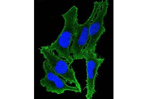 Immunofluorescent analysis of 4 % paraformaldehyde-fixed, 0. (ATP2B3 antibody  (C-Term))