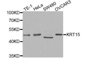 Western blot analysis of extracts of various cell lines, using KRT15 antibody.