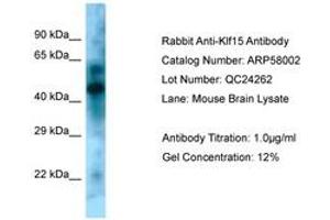 Image no. 1 for anti-Kruppel-Like Factor 15 (KLF15) (N-Term) antibody (ABIN6749944) (KLF15 antibody  (N-Term))