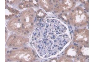 DAB staining on IHC-P; Samples: Human Kidney Tissue (PC antibody  (AA 36-486))