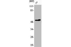 Western Blot analysis of 293 cells using Phospho-ATF-2 (T73) Polyclonal Antibody (ATF2 antibody  (pThr73))