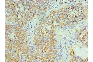 Immunohistochemistry of paraffin-embedded human tonsil tissue using ABIN7171432 at dilution of 1:100 (CCT6A antibody  (AA 80-250))