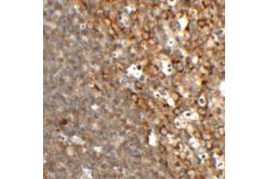 Immunohistochemistry of TFCP2L1 in rat colon tissue with TFCP2L1 antibody at 2. (TFCP2L1 antibody  (N-Term))