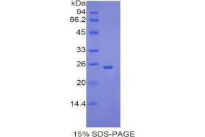 SDS-PAGE analysis of Mouse UCHL5 Protein.