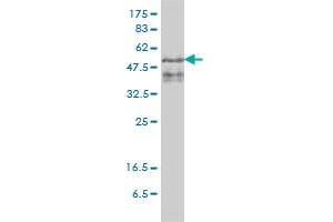 ZFYVE19 monoclonal antibody (M01), clone 4D5-2D11 Western Blot analysis of ZFYVE19 expression in PLC/PRF/5 . (ZFYVE19 antibody  (AA 1-396))