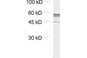 dilution: 1 : 1000, sample: unboiled synaptic membrane fraction of rat brain (LP1) (GABRB1 antibody  (AA 342-430))