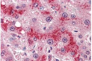 Human Liver (formalin-fixed, paraffin-embedded) stained with LEPR antibody ABIN364407 at 4 ug/ml followed by biotinylated anti-goat IgG secondary antibody ABIN481715, alkaline phosphatase-streptavidin and chromogen. (Leptin Receptor antibody  (AA 829-841))