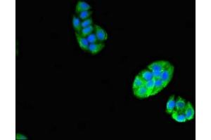 Immunofluorescent analysis of PC-3 cells using ABIN7175304 at dilution of 1:100 and Alexa Fluor 488-congugated AffiniPure Goat Anti-Rabbit IgG(H+L) (VPS29 antibody  (AA 68-145))