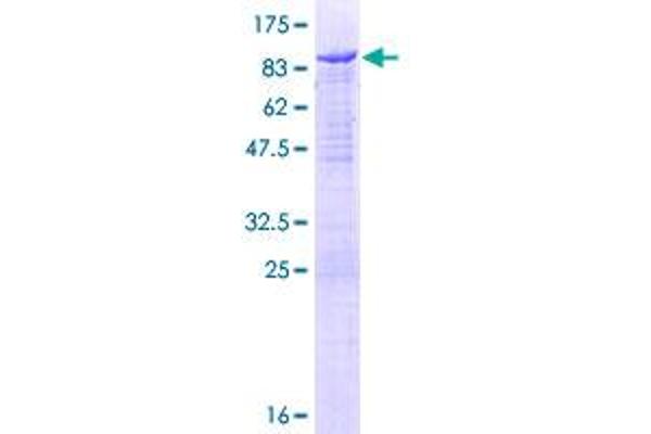 Neural Wiskott-Aldrich syndrome protein (WASL) (AA 1-505) protein (GST tag)