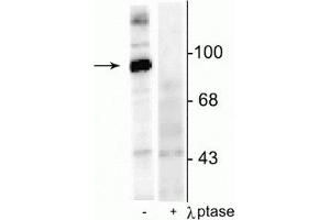 Western blot of rat hippocampal lysate stimulated with forskolin showing specific immunolabeling of the ~95 kDa dynamin phosphorylated at Ser774 in the first lane (-). (Dynamin 1 antibody  (pSer774))