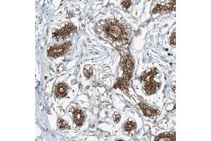 Immunohistochemical staining of human breast with COMMD8 polyclonal antibody  strong cytoplasmic positivity in glandular cells at 1:50-1:200 dilution. (COMMD8 antibody)