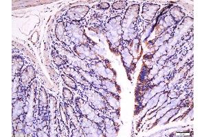 Immunohistochemistry (Paraffin-embedded Sections) (IHC (p)) image for anti-Fibronectin (AA 1201-1300) antibody (ABIN671646)