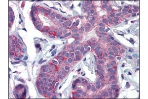 Immunohistochemistry Image: Human Breast: Formalin-Fixed, Paraffin-Embedded (FFPE) (PPARD antibody  (C-Term))