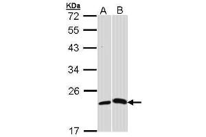 WB Image Sample (30 ug of whole cell lysate) A: H1299 B: Molt-4 , 12% SDS PAGE antibody diluted at 1:1000 (CRP antibody)