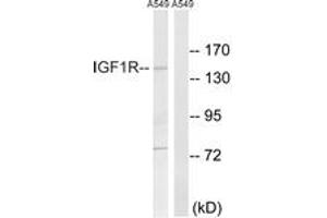 Western blot analysis of extracts from A549 cells, using IGF1R (Ab-1346) Antibody. (IGF1R antibody  (AA 1311-1360))