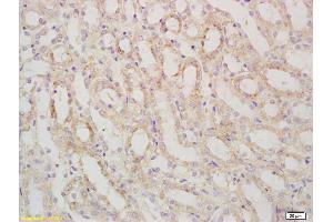 Formalin-fixed and paraffin embedded mouse kidney labeled with Rabbit Anti SARM1 Polyclonal Antibody, Unconjugated (ABIN1387556) at 1:200 followed by conjugation to the secondary antibody and DAB staining (SARM1 antibody  (AA 340-380))