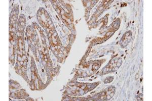 IHC-P Image Immunohistochemical analysis of paraffin-embedded human colon, using PKA alpha, antibody at 1:100 dilution. (PRKACA antibody  (Center))